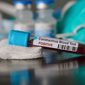 Potrjenih pet novih okužb, smrti zaradi covida-19 ni bilo