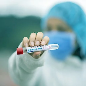 Sedem novih okužb z novim koronavirusom, umrl ni nihče
