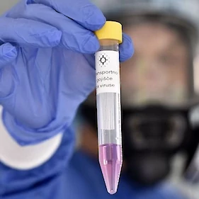 Včeraj ob 560 testih potrjenih 14 okužb z novim koronavirusom