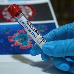 Po 919 testiranjih potrjenih 14 okužb z novim koronavirusom