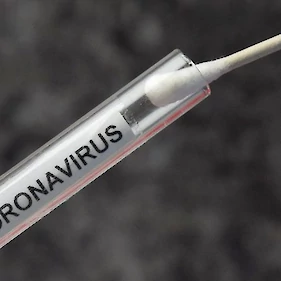 Včeraj potrdili 1752 okužb z novim koronavirusom, umrlo 32 ljudi